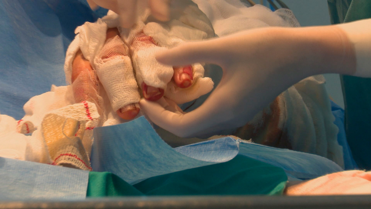 Así es por dentro la Unidad de Quemados de la Paz