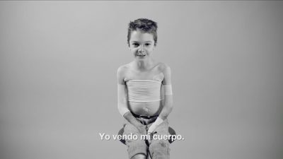 Campaña para mejorar la vida de quienes padecen “piel de mariposa”