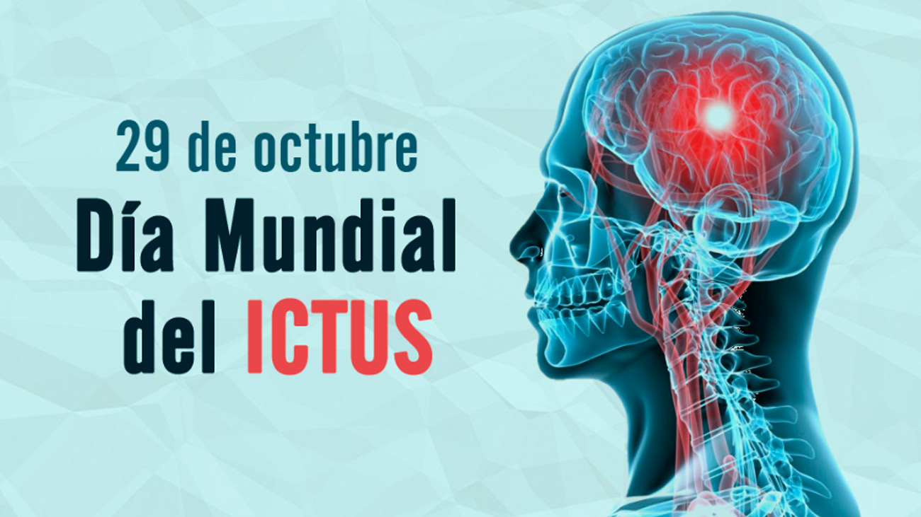 Una de cada seis personas sufrirá un ictus a lo largo de su vida