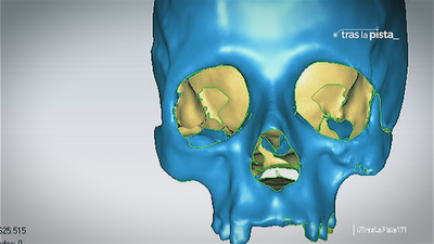 La reconstrucción de cadáveres mediante el proyecto CRÁNEO
