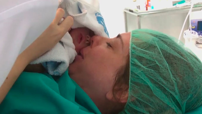 ¿Cómo es un parto prematuro de gemelos?