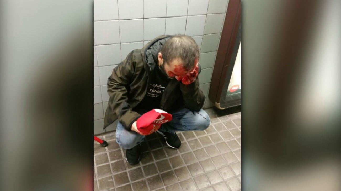 Herido un hombre tras un empujón en el metro cuando lucía una gorra de España
