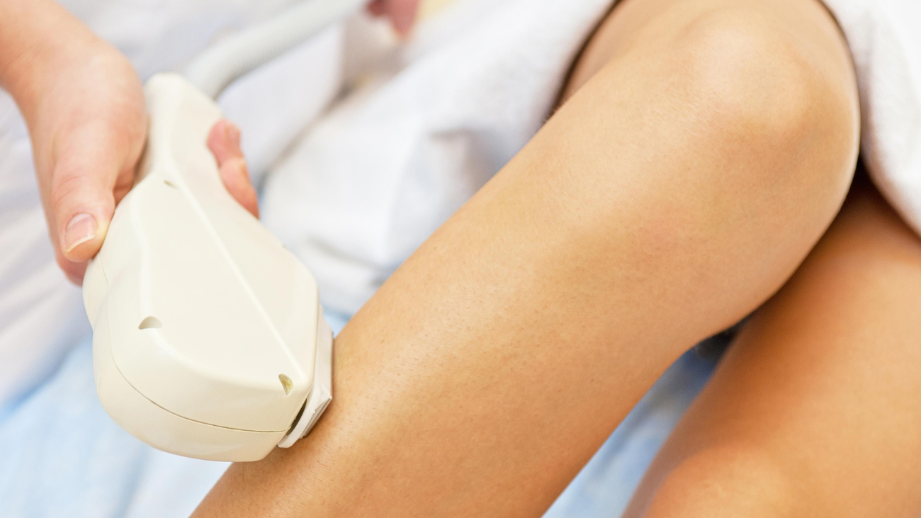 La depilación láser, otra polémica moda que llega a España