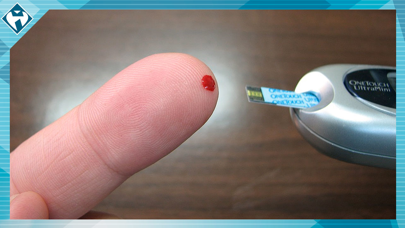 La diabetes tipo 2 es el tipo más común de diabetes