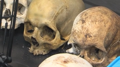 ¿Por qué hay tan pocos médicos forenses en la Comunidad de Madrid?