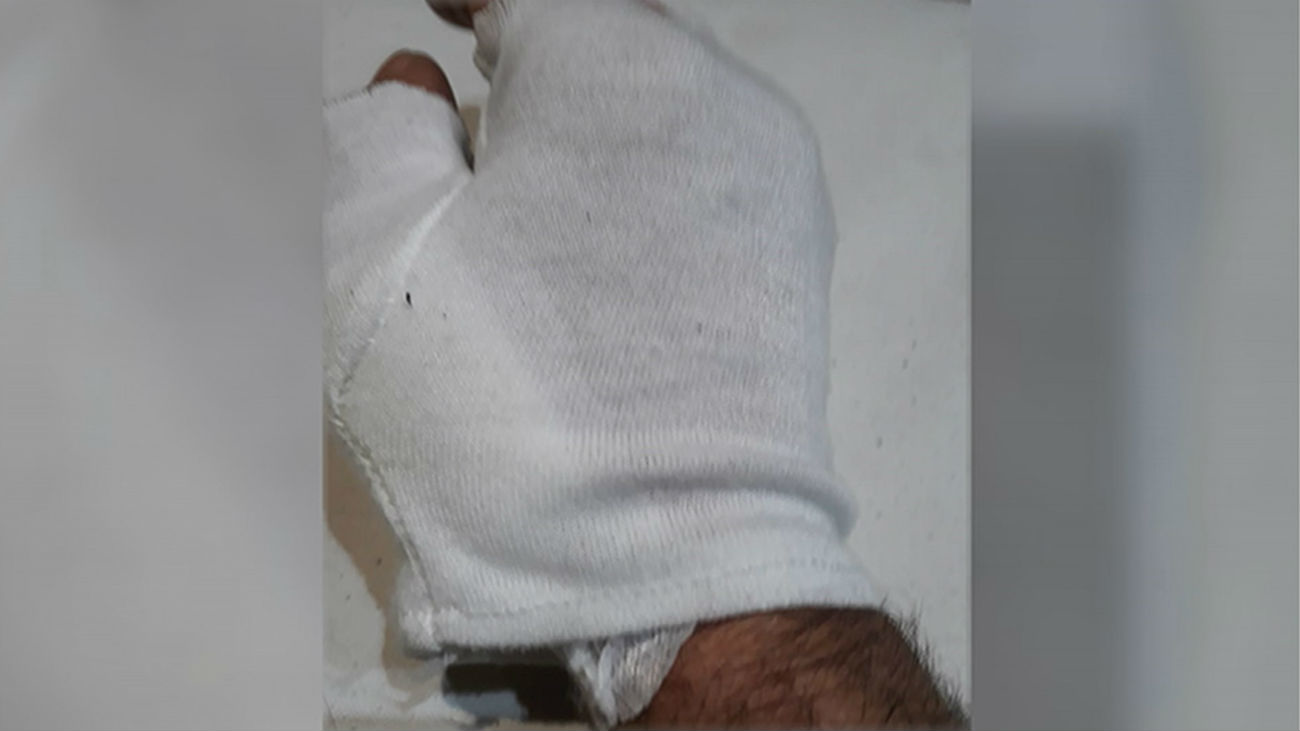 Atacado por un perro peligroso mientras miraba un escaparate