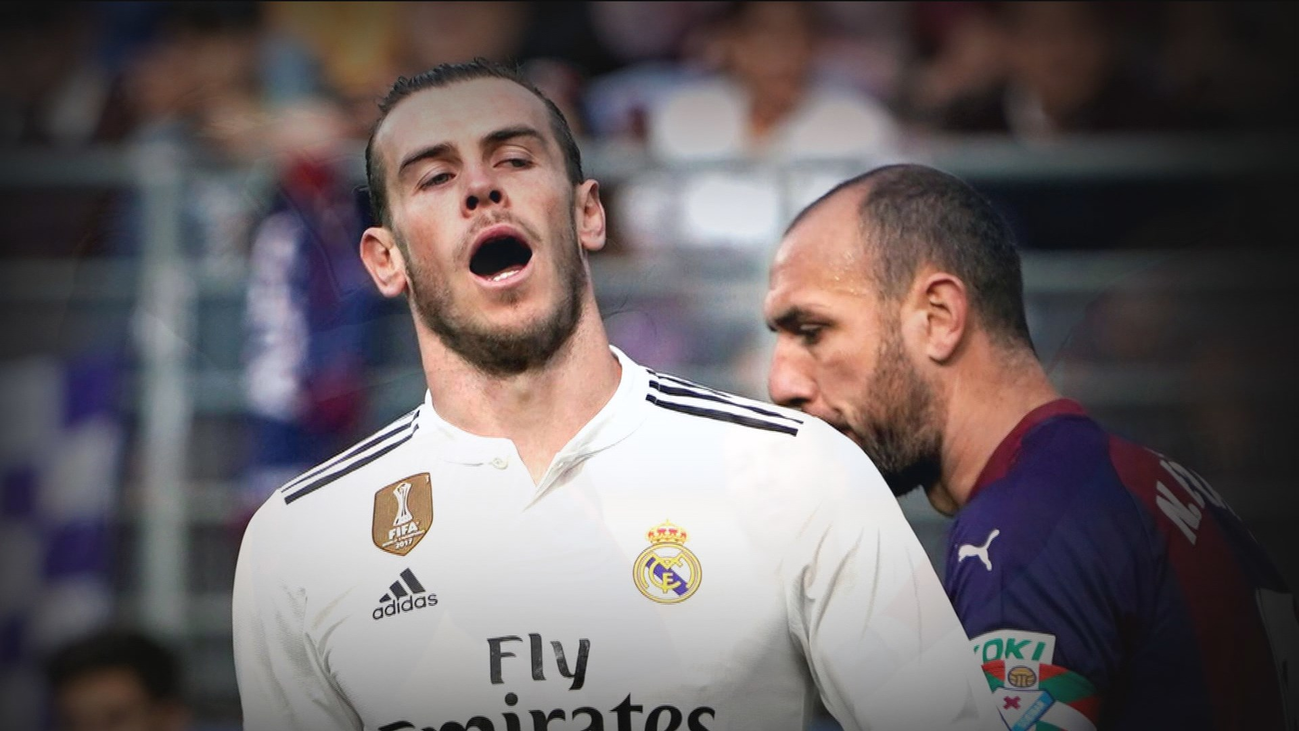 Los males del Real Madrid