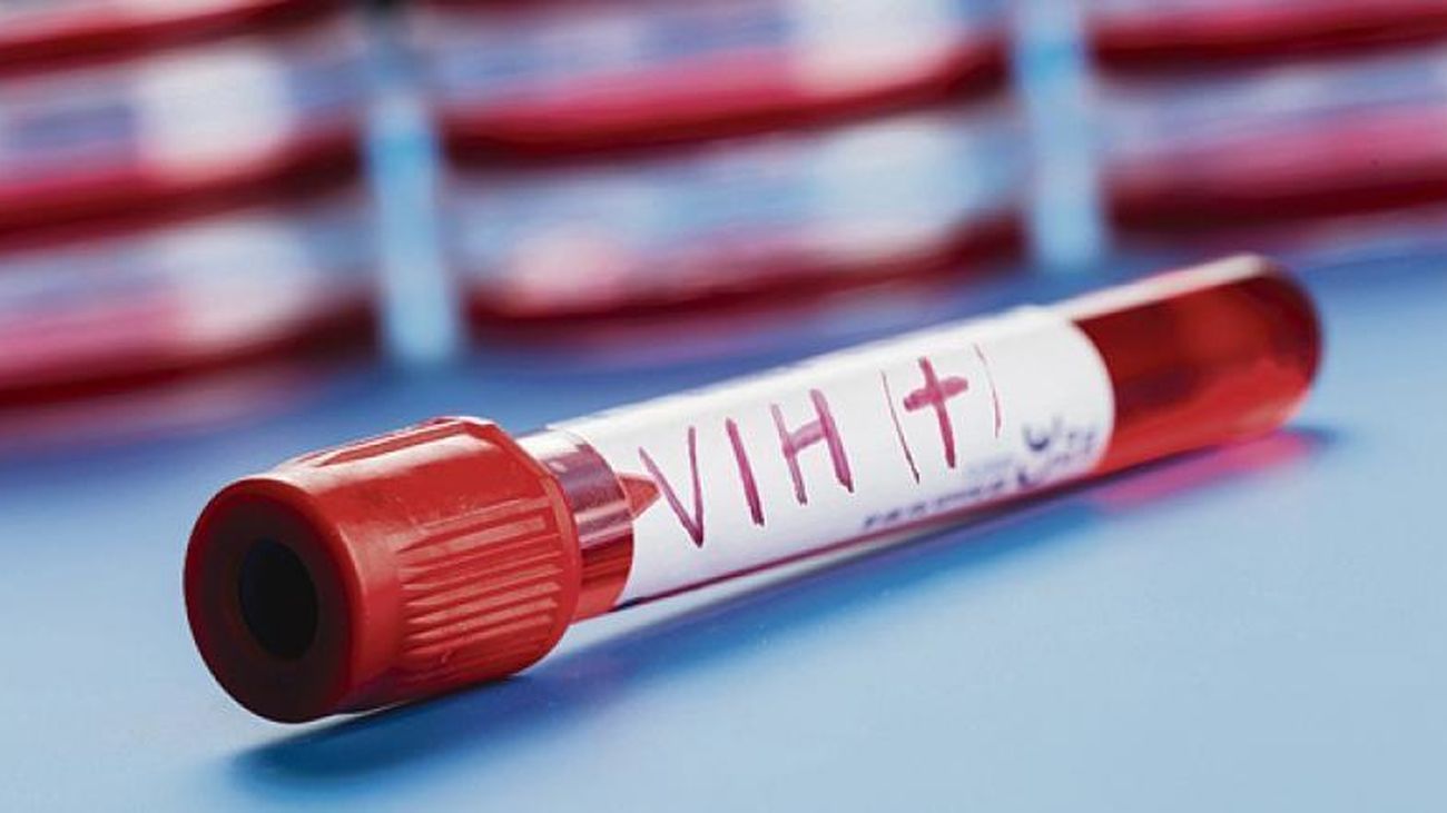 Para un 64%  de los españoles encuestados, el VIH es un problema de salud pública.