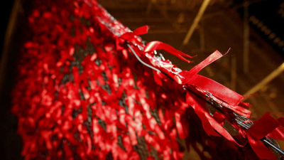 Frenar el envejecimiento prematuro  en personas con VIH, el reto "inesperado"