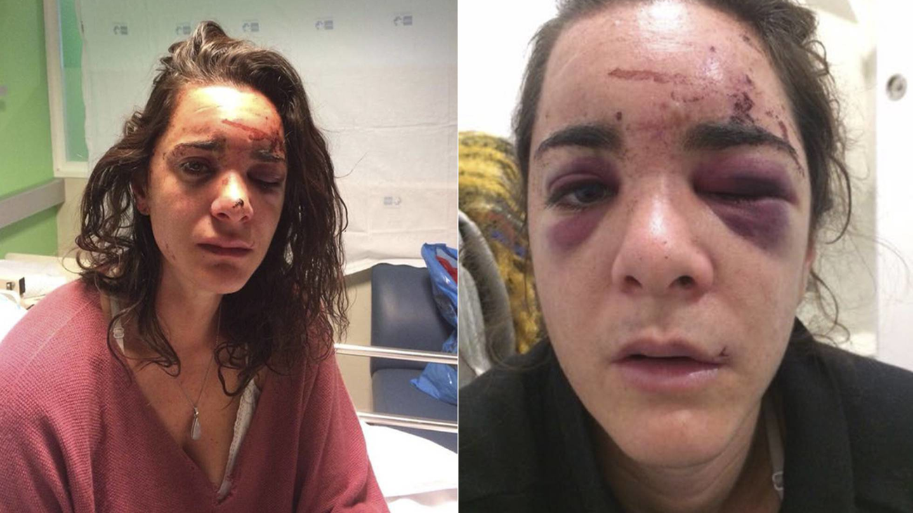 Detenido el presunto violador de una joven americana en Madrid