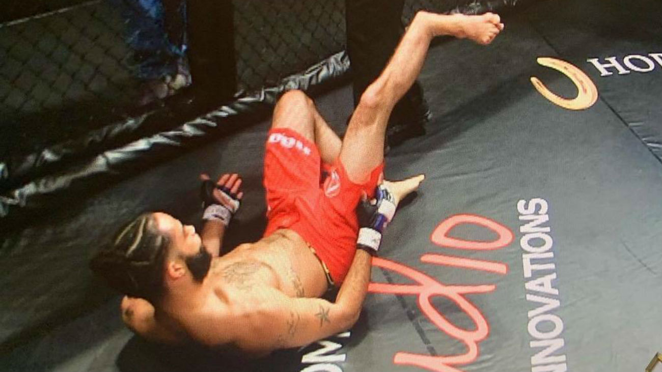 Escalofriante fractura