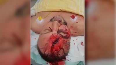 El clima político alemán se envenena