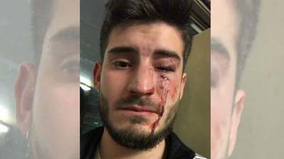 Detenidas dos personas por una agresión homófoba en el metro de Barcelona