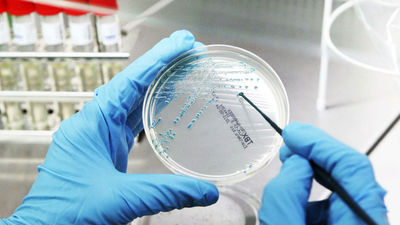 Numerosos actos este lunes con motivo del Día Mundial contra el Cáncer