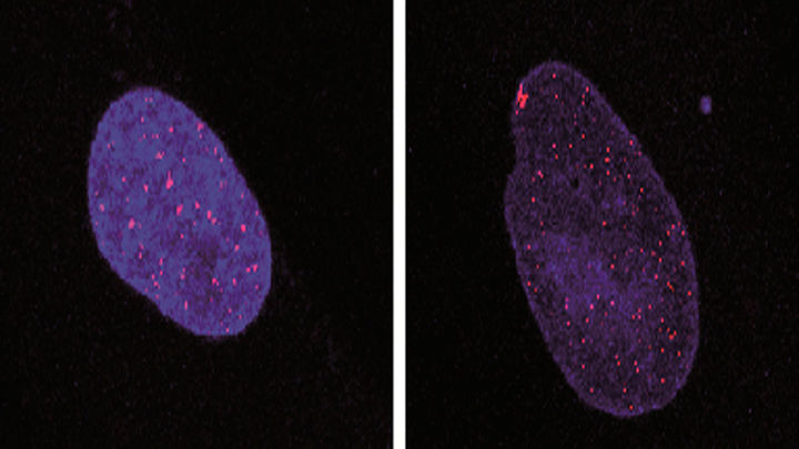 Investigadores españoles hallan una diana terapéutica para la ataxia telangiectasia