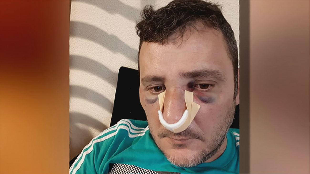 Brutal agresividad de un repartidor de Amazon con un conserje