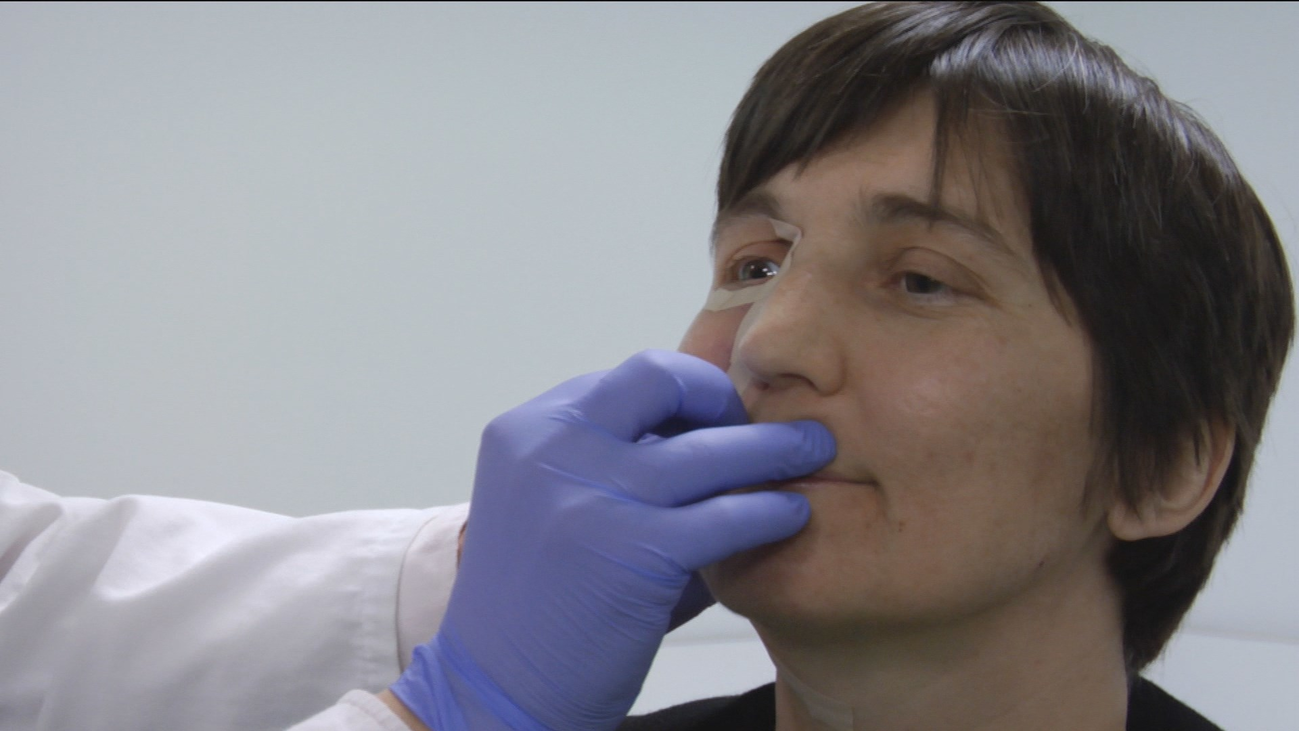 Nos adentramos en la unidad de prótesis faciales del Hospital Ramón y Cajal