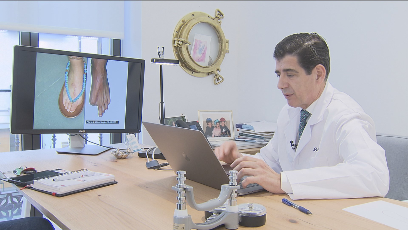 El milagro de trasplantar dedos de los pies a las manos