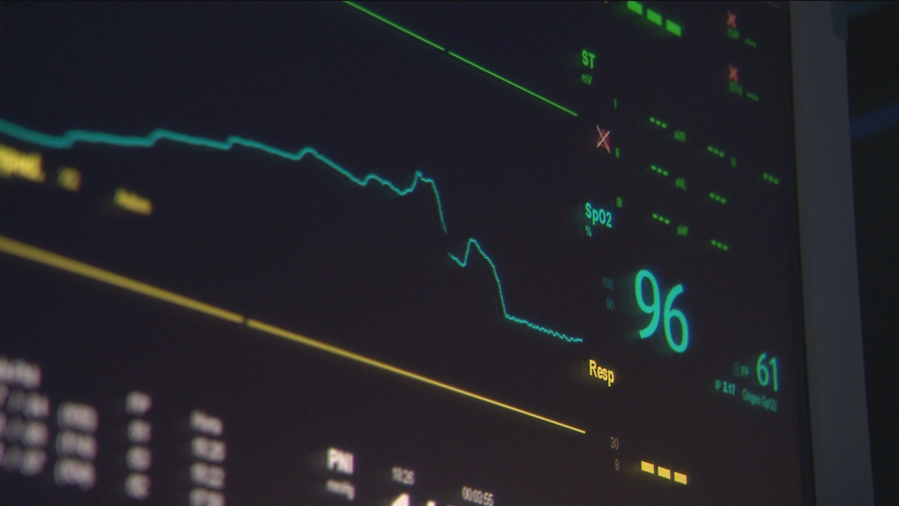Operan a un hombre del corazón tras un error con los electrocardiogramas