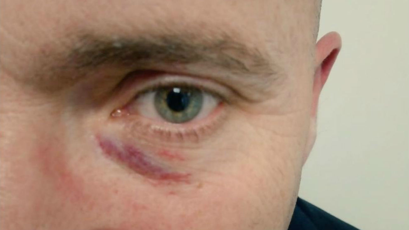 El joven que agredió a Rajoy ataca al coordinador local de Vox en Pontevedra