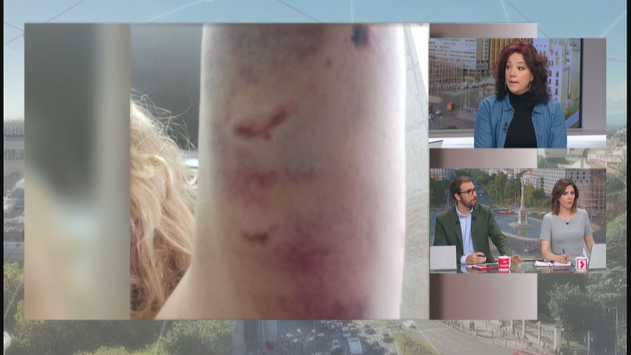 Salvó a una anciana de dos pitbull y ahora tiene que pagar 7.000 euros