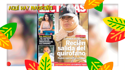 Carmen Borrego se vuelve a operar de la papada