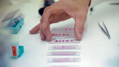 La primavera será más suave para los alérgicos por bajas lluvias en invierno