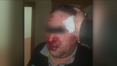 Un vigilante del centro de Hortaleza denuncia que fue agredido por menores