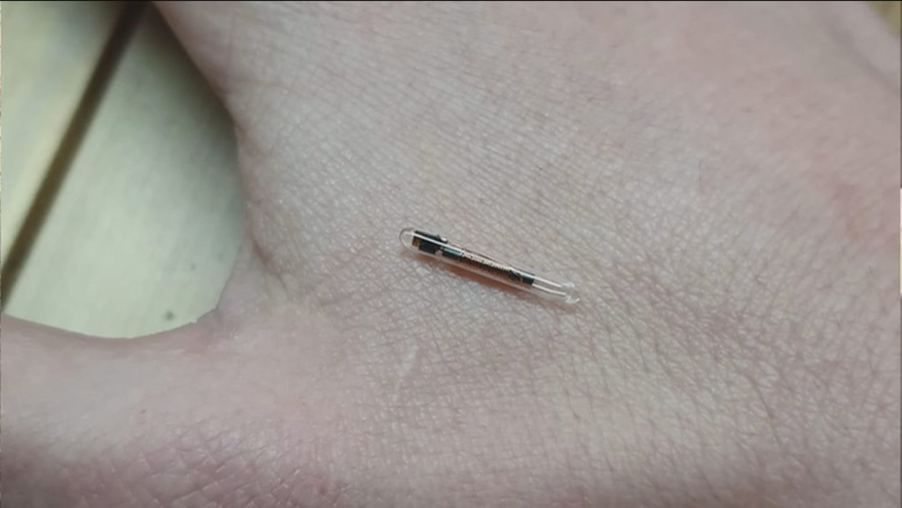 ¿Cómo es vivir con un chip instalado en tu propio cuerpo?
