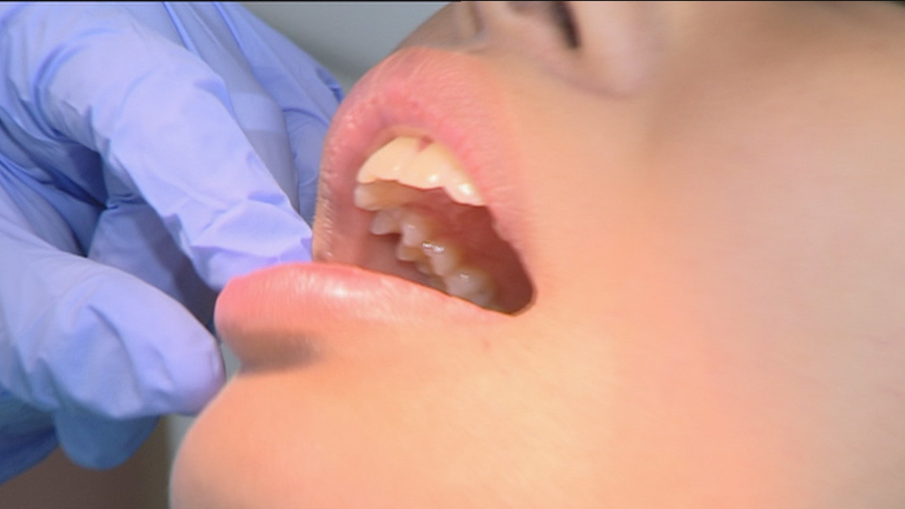 ¿Debes conservar los dientes de leche por sus células madre?