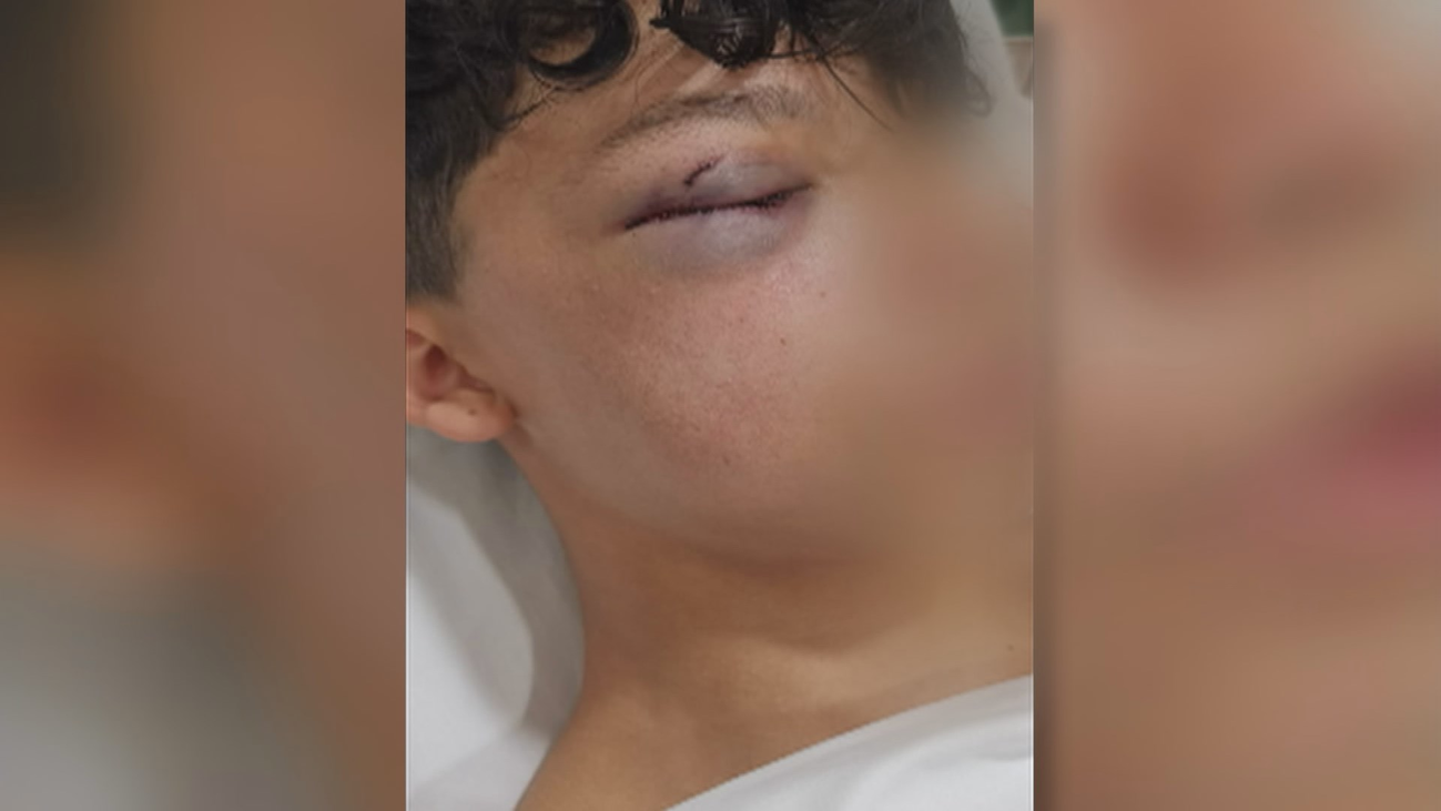 Agresión brutal a un menor en Villa de Vallecas