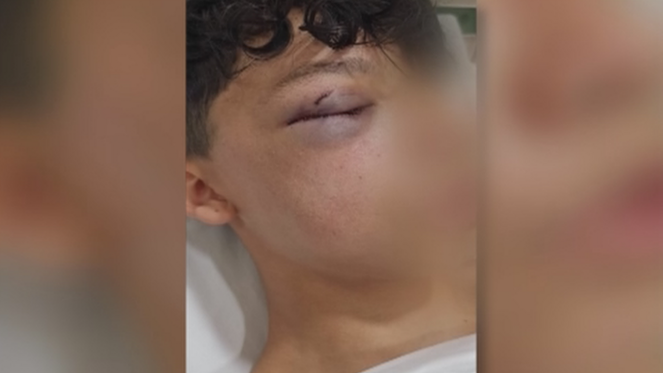 David, el menor brutalmente agredido en Vallecas: “Me esperaban 50 personas para darme una paliza”