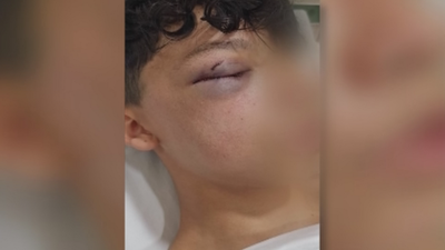 David, el menor brutalmente agredido en Vallecas: “Me esperaban 50 personas para darme una paliza”