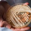 Cándida Auris, el hongo hiperresistente que amenaza la salud del planeta