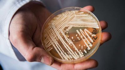 Cándida Auris, el hongo hiperresistente que amenaza la salud del planeta