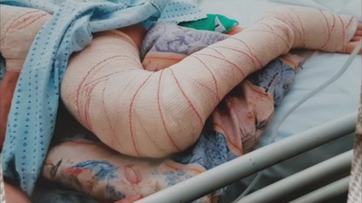 Una anciana sufre varias roturas óseas sin ser atendida en una residencia de Valdebernardo