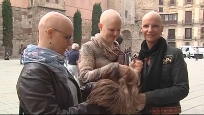 Nace el colectivo ‘Apelo’, que reivindica la calvicie en las mujeres