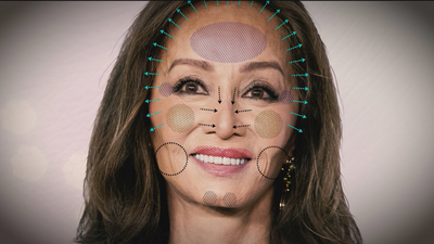 Los retoques estéticos de Isabel: "Parece que tiene 10 ó 15 años menos"