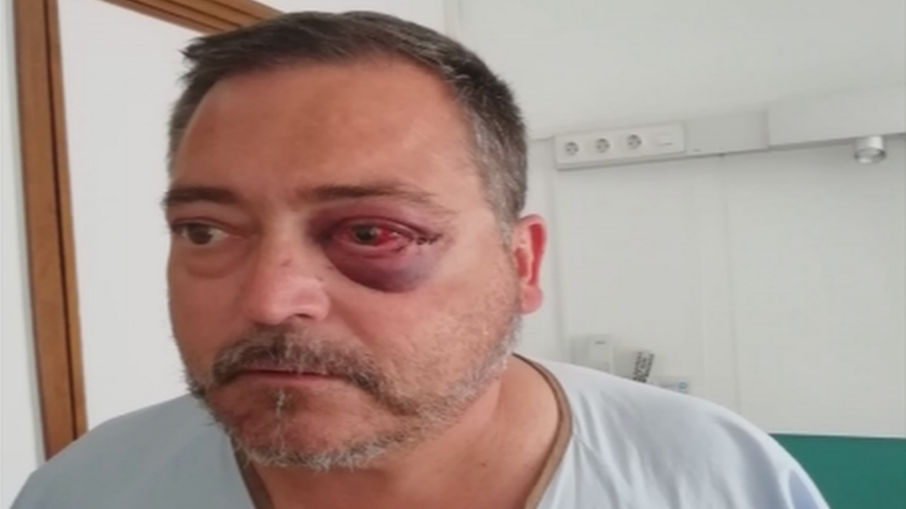 Le rompen la órbita del ojo por pedir que apartaran sus bicicletas en Fuenlabrada