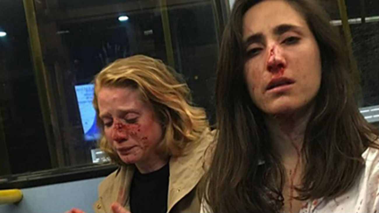 Agresión homófoba a dos lesbianas en Londres
