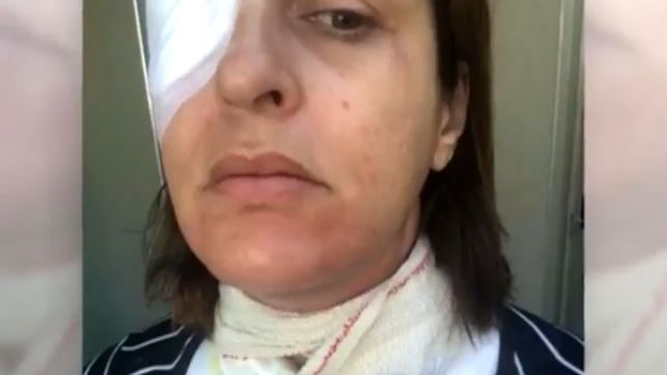 Dos mujeres denuncian graves quemaduras por la explosión de un robot de cocina