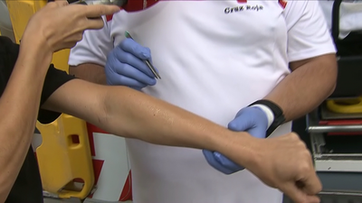 ¿Cómo actuar ante una picadura de medusa?