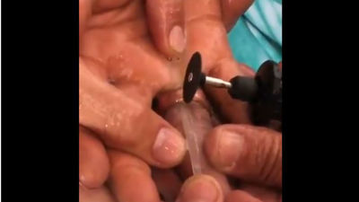 Los bomberos de Fuenlabrada liberan a dos mujeres de los anillos que 'estrangulaban' sus dedos