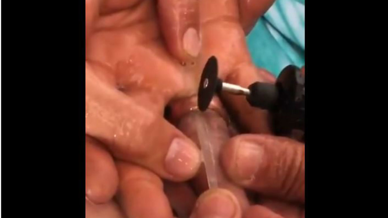 Los bomberos de Fuenlabrada liberan a dos mujeres de los anillos que 'estrangulaban' sus dedos