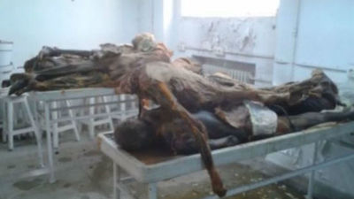 Procesado el exdirector de Anatomía de la Complutense por la acumulación de cadáveres