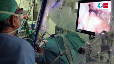 Operar sin cicatriz en el hospital de Parla