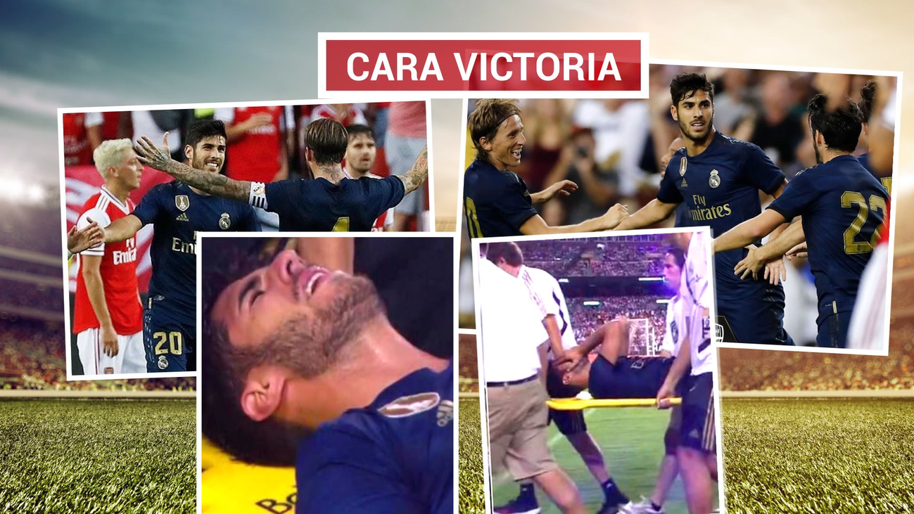 Grave lesión de Asensio, rotura del ligamento cruzado de la rodilla izquierda