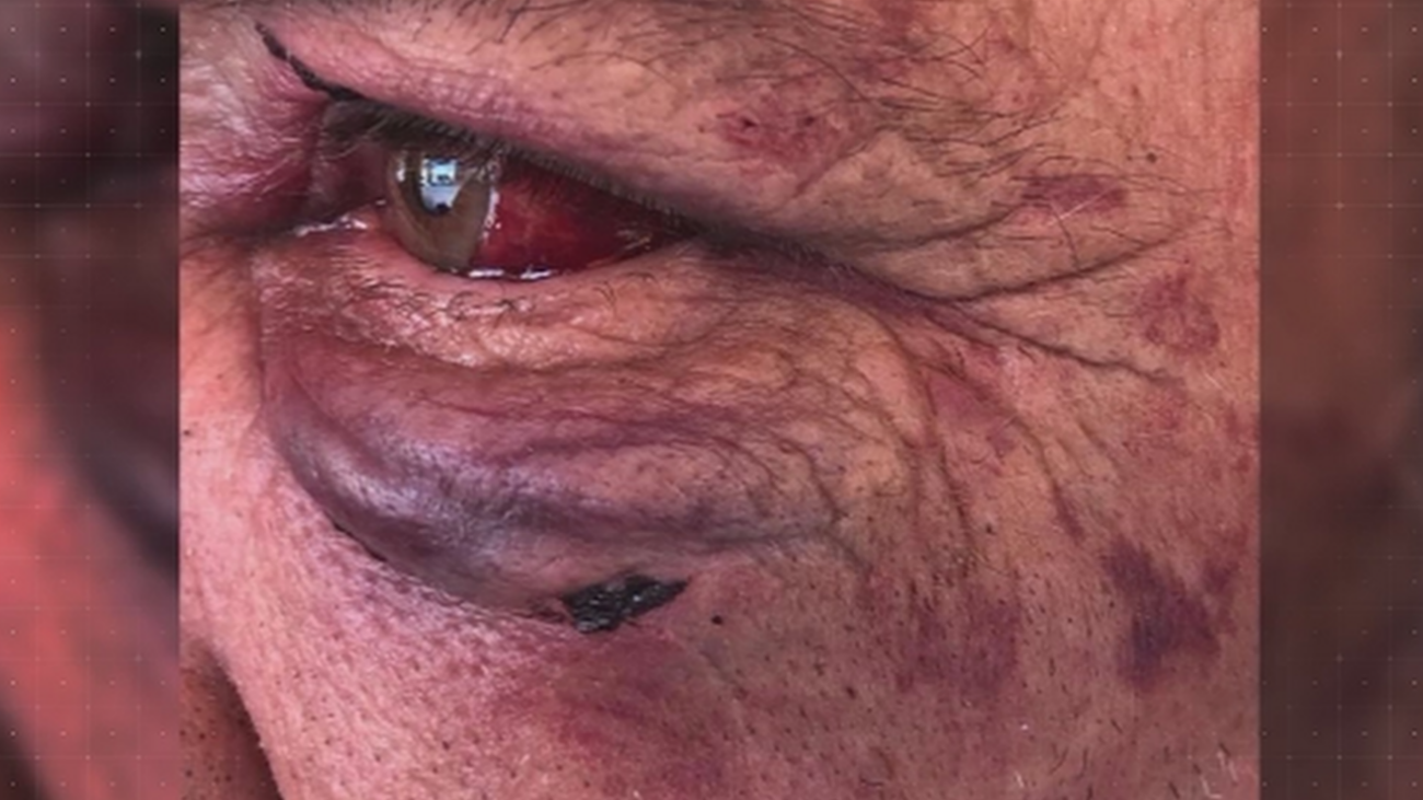 Agreden brutalmente a un hombre en Parla para robarle la cartera (vacía)