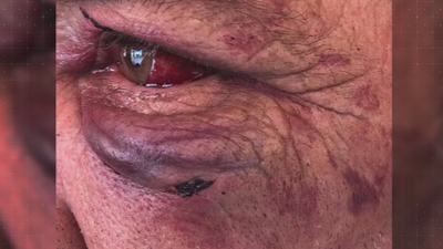 Agreden brutalmente a un hombre en Parla para robarle la cartera (vacía)