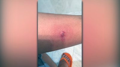 Invasión de mosquitos en el Hospital de La Princesa